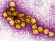West Nile Virus Image