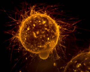 Breast Cancer Prediction Using Deep Learning and Machine Learning Techniques